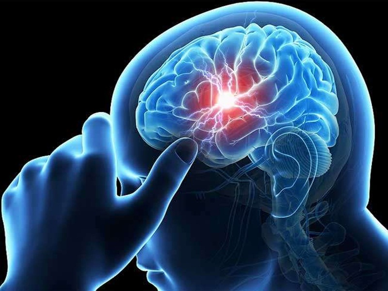 12 05 2022 brain stroke